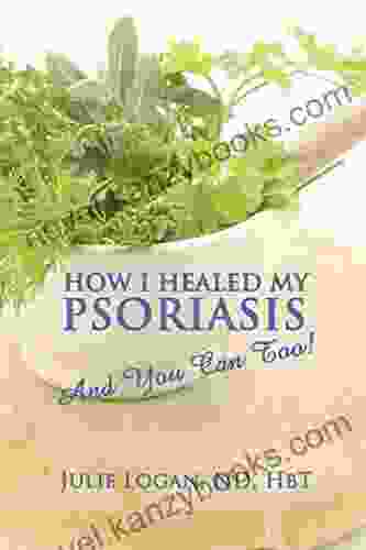 How I Healed My Psoriasis: And You Can Too