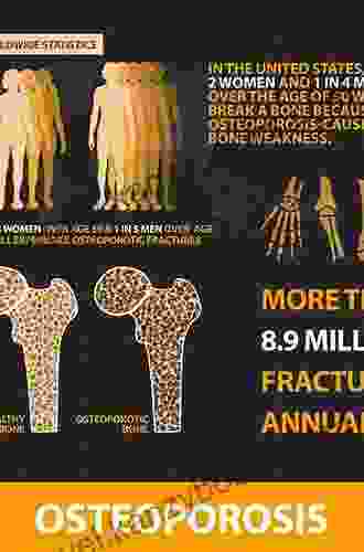 Bone Loss And Osteoporosis: An Anthropological Perspective