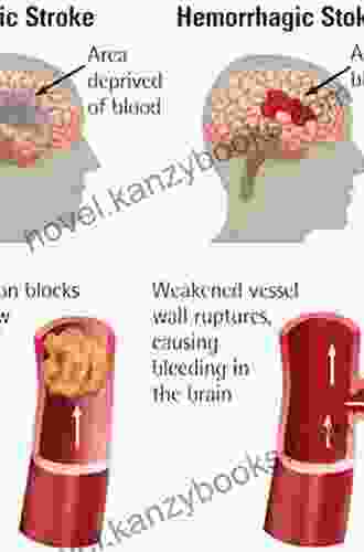 Hemorrhagic And Ischemic Stroke: Medical Imaging Surgical And Interventional Approaches