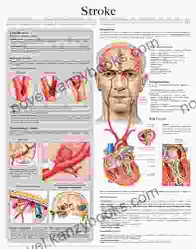 Stroke E Chart: Full Illustrated Tyler Spellmann