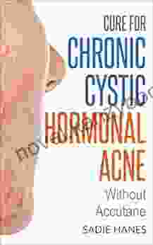 Cure For Chronic Cystic Hormonal Acne : Without Accutane (Healthy Hormones)